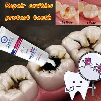 Bielenie zubov Zubnou Rýchle Opravy Dutín Kazu Svieži Dych Odstránenie Plaku Opravu Zubov Výrobok pre Starostlivosť o Nový Upgrade